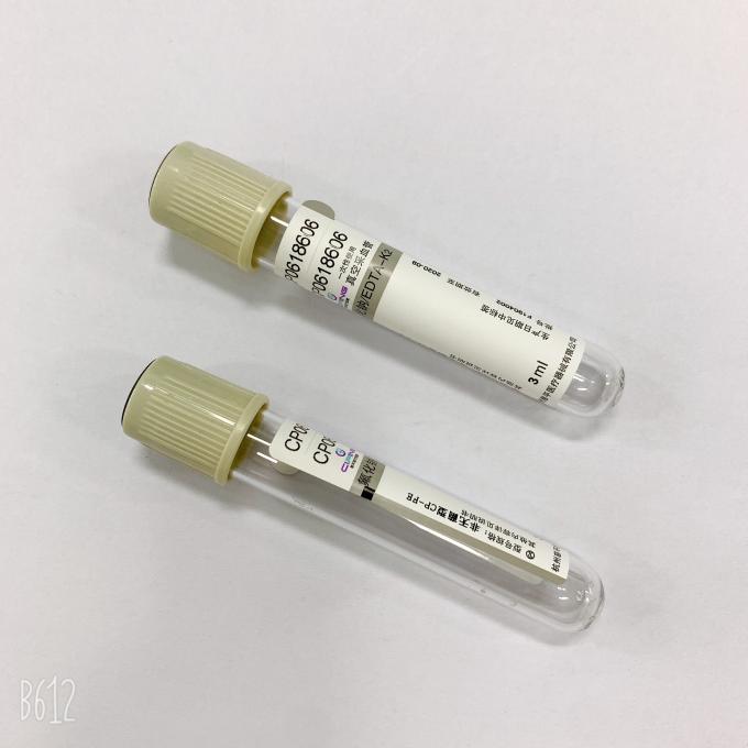 Professional Glucose Blood Tube Sodium Fluoride Grey Top Tube For Glucose