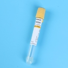 Disposable Yellow Cap PET Vacuum Pro Coagulation Tube 1ml - 10ml