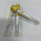 5ml Gel Clot Activator Tube Yellow Cap 1ml - 8ml Serum Specimen