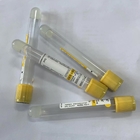 5ml SST Tube Yeollow Head Cover Medical Disposable Vacuum Blood Collection Tube
