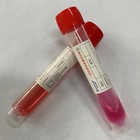 Mixed Disposable Virus Sampling Tube COVID 19 Test Plastic B-12.0