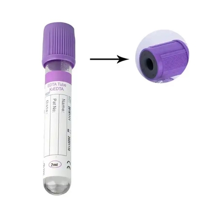 Specialized EDTA Tube For Preventing Clotting In Whole Blood Or Plasma Samples