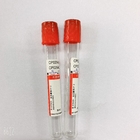 Customized 	Plain Blood Collection Tube Anticoagulant  Plain Vacutainer Tubes