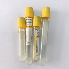 Serum Separating Yellow Cap Vacutainer 5ml  Accurate Vacuum Draw Volume