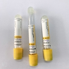 Biochemical Test Gel And Clot Activator Tube 1ML-10ML Customized Logo