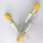 Silicon Sodium Citrate Acd Blood Collection Tubes  High Stability