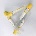 Silicon Sodium Citrate Acd Blood Collection Tubes  High Stability