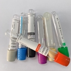 Professional Vacuum Blood Collection Tube Of Sodium Fluoride Potassium Oxalate