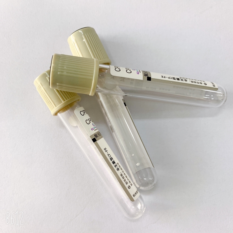 Disposable Glucose Blood Tube Sodium Fluoride Potassium Oxalate Additive