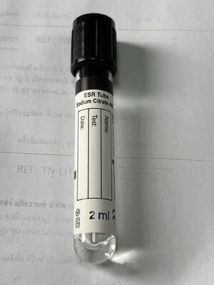 1.6ml ESR Vacuum Tube with 3.8% Sodium Citrate for Sedimentation Rate